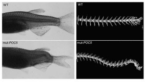 Un poisson-zèbre et une scoliose