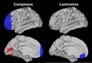 en bleu et en rouge, les images de connectivité fonctionnelle montrant, par rapport aux contrôles, une baisse de connectivité (bleu) dans le cortex prefrontal des Complexes et dans le cortex orbite-frontal des Laminaires et une augmentation de connectivité dans le cortex occipital-temporal des Complexes.