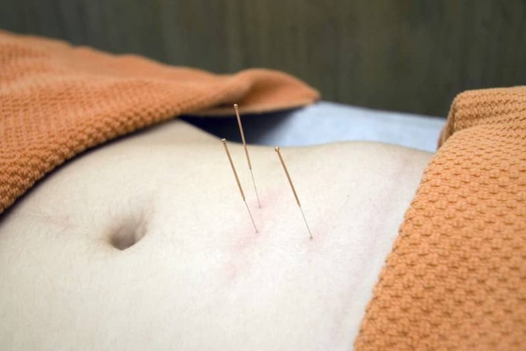 acupuncture médecine douce Ra Santé