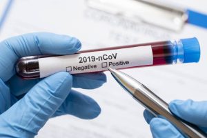 test sérologie covid-19