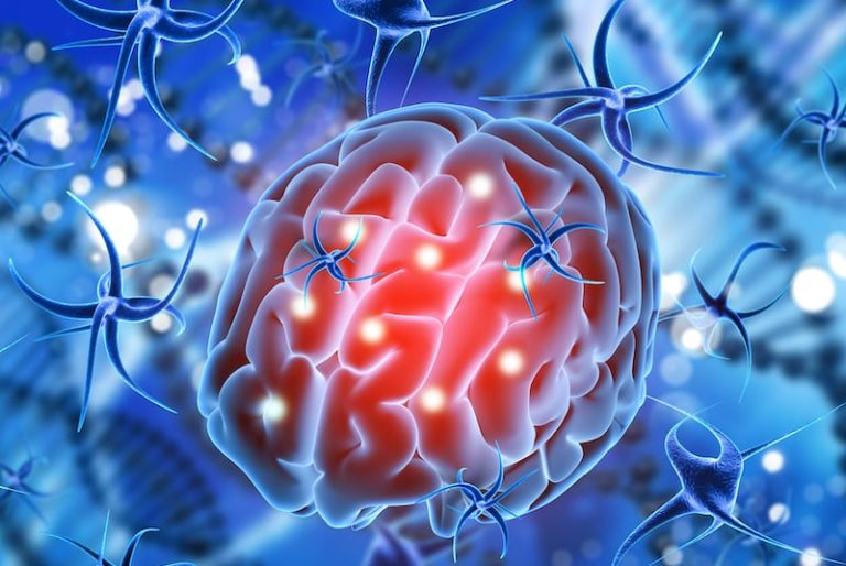Impact du Covid-19 sur le cerveau.