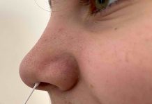 Coronavirus : je suis cas contact… que faut-il faire ? test antigénique
