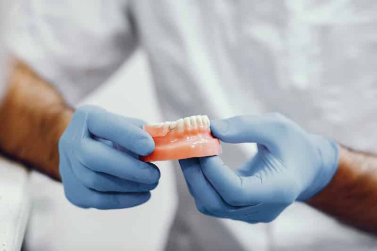 Tout savoir sur les implants dentaires.