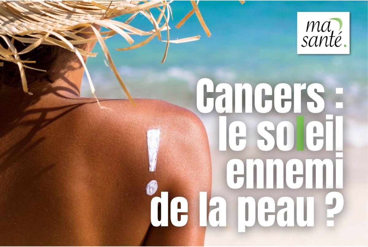 cancer peau