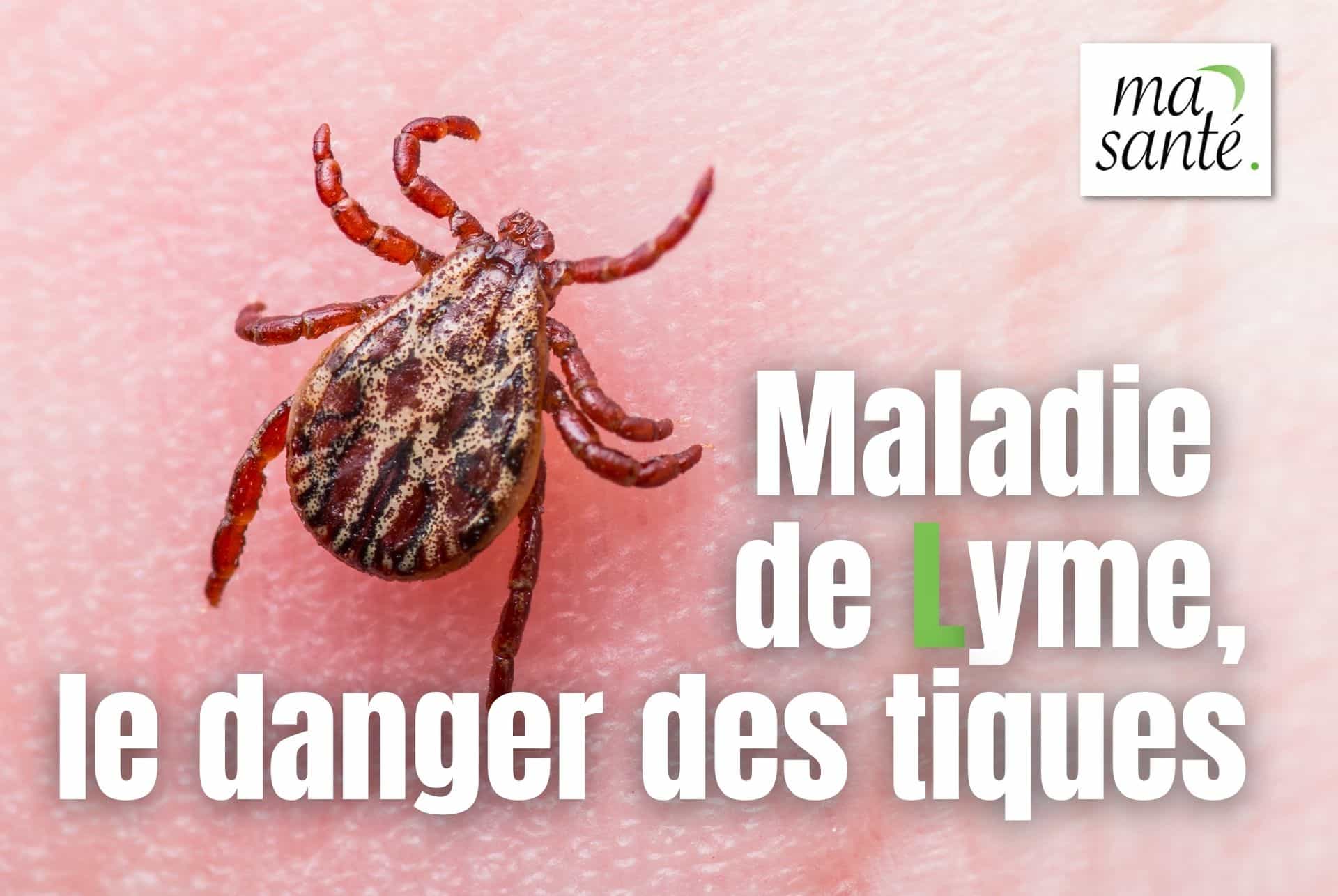 maladie lyme tiques