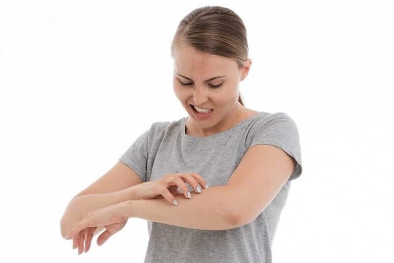 Le psoriasis, une maladie incurable, douloureuse et invalidante.