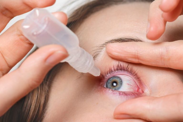 conjonctivite : inflammation de la conjonctive