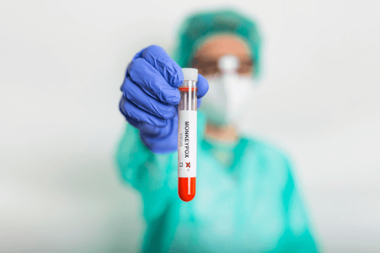 L'épidémie de variole du singe progresse en France.