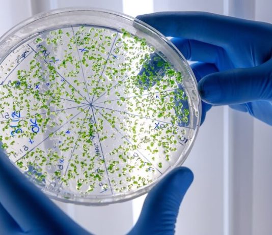 La bactérie listeria étudiée dans un laboratoire.