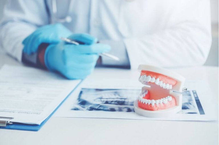 Tout connaître sur le dentier !