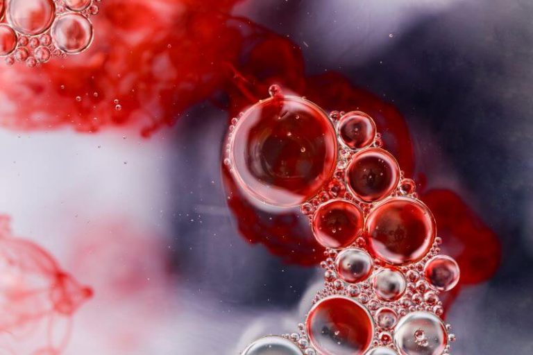 Une hémorragie sanguine due à un cas d'hémophilie.