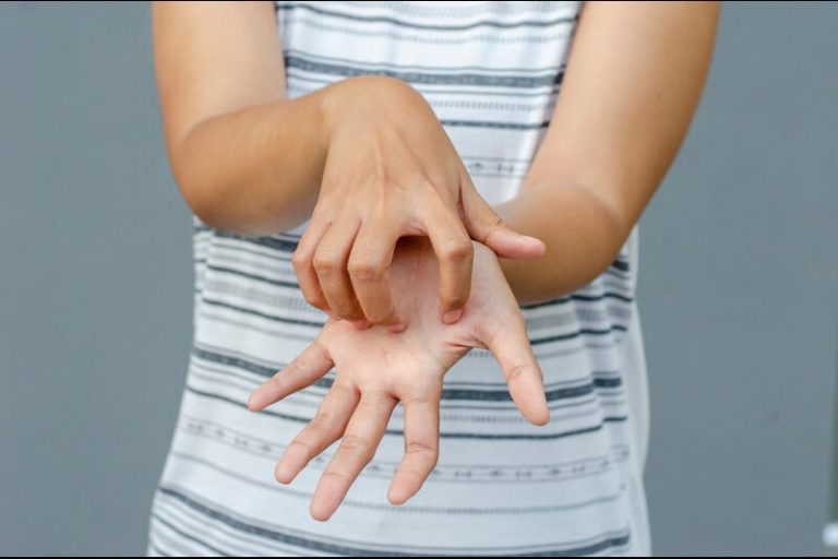 Main droite qui gratte : fruit du hasard ou pathologie réelle ?