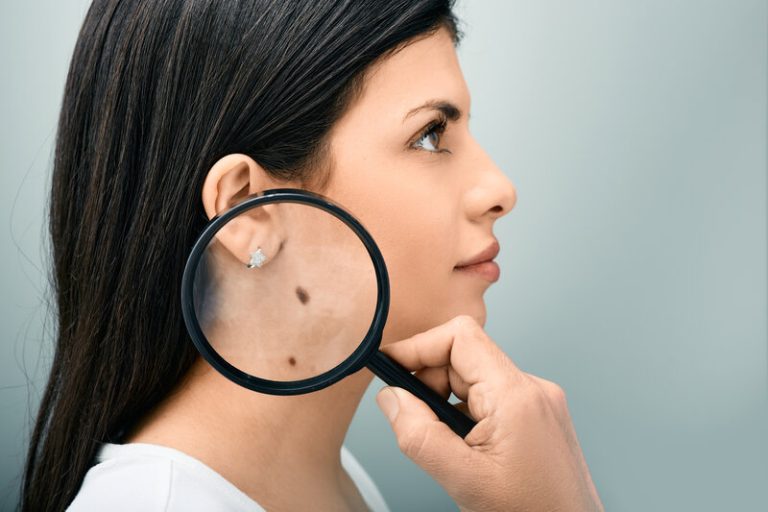 Une femme avec un grain de beauté dans le cou.