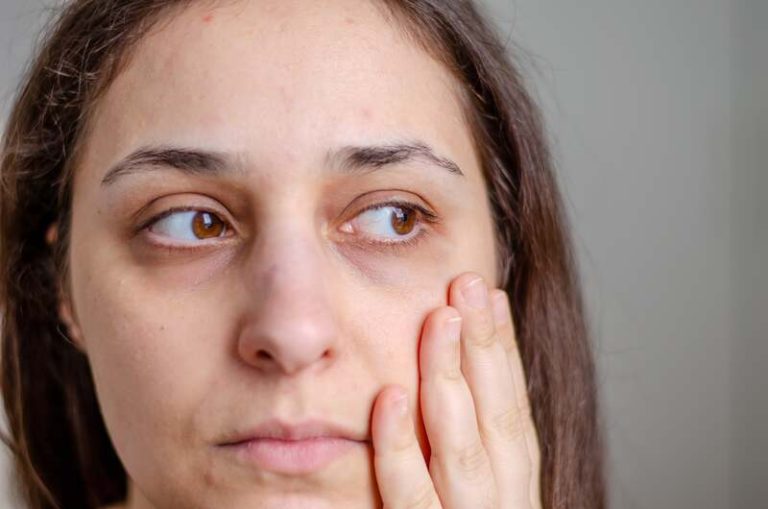 Une femme avec des cernes imposants.
