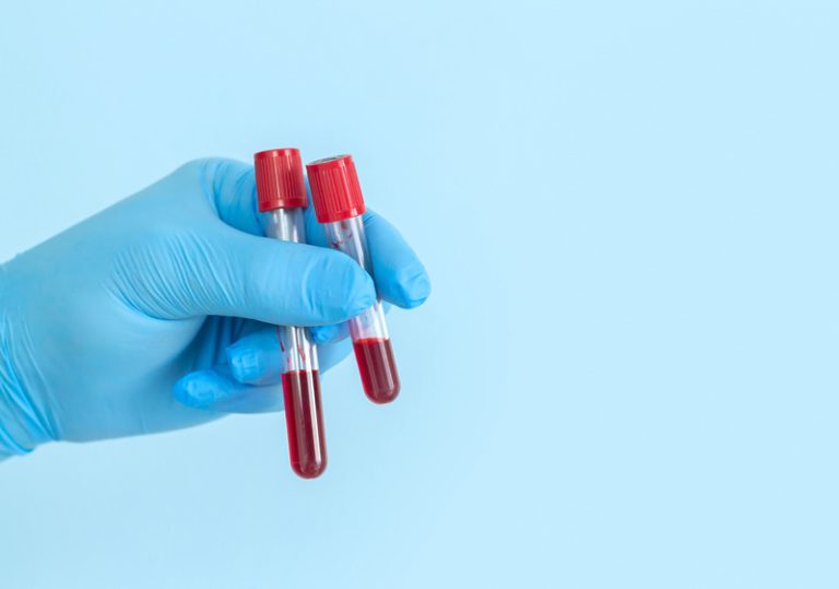 Une main de médecin qui tient deux tubes remplis de sang à la suite d'une prise de sang.