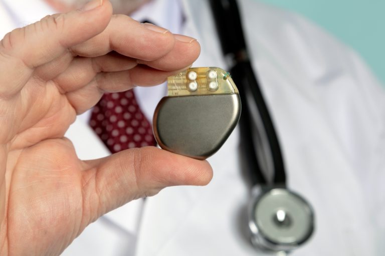 Un médecin qui tient un défibrillateur automatique implantable dans la main.