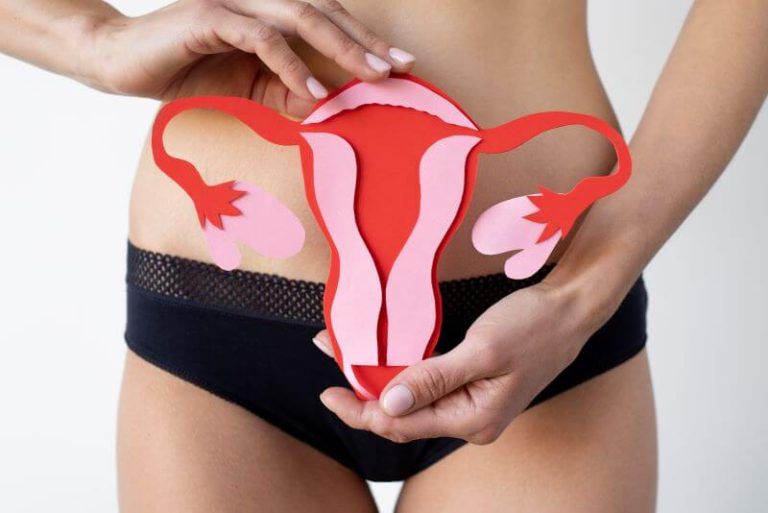 femme tenant une représentation de l'appareil reproducteur féminin pour symboliser les douleurs gynécologiques et les troubles liés à l’endométriose