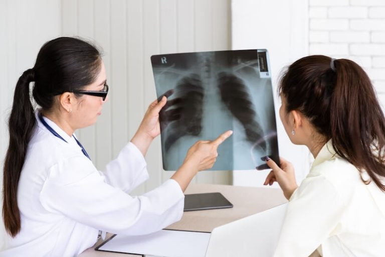 Un médecin annonçant le diagnostic du cancer du poumon à sa jeune patiente.