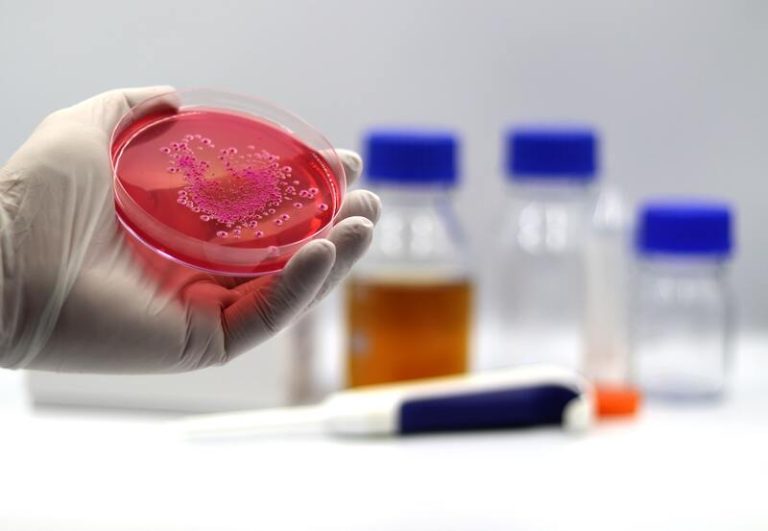 Un médecin qui examine les bactéries résistantes aux antibiotiques.