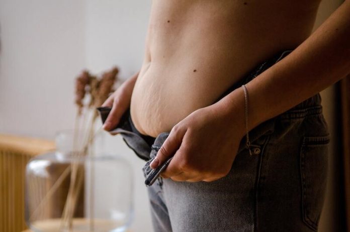 syndrome cushing femme prise de poids inexpliquée Ma Santé Une femme atteinte du syndrome de Cushing et victime d'une prise de poids inexpliquée.