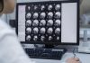 Dépression sévère : un nouveau traitement par ultrasons révèle son efficacité Images d'un crâne sous traitement ultrasons contre la dépression résistante voire sévère.