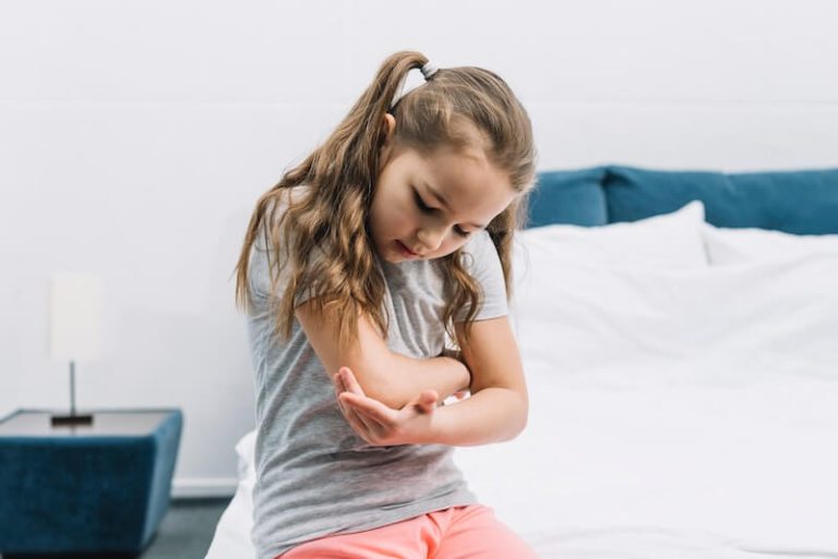 Une petite fille atteinte d'eczema atopique.
