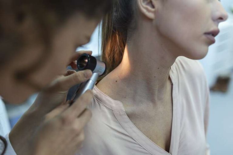 Une femme qui suspecte un mélanome à cause d'une surproduction d'hormones féminines appelées œstrogène.