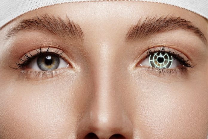 Une femme en passe de recevoir une chirurgie des yeux : la kérato-pigmentation.