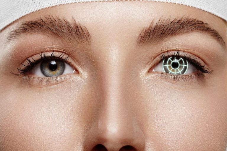Une femme en passe de recevoir une chirurgie des yeux : la kérato-pigmentation.