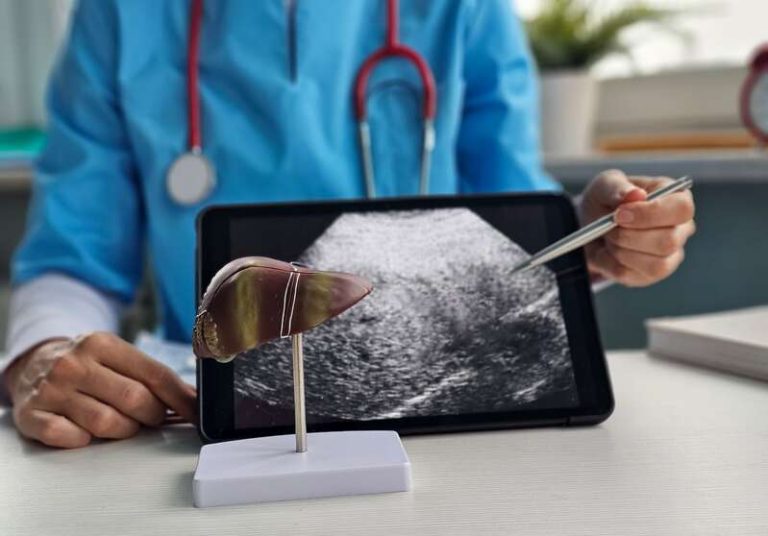 Un médecin qui montre la progression d'un cancer du foie via un scanner.