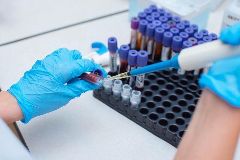 Un chercheur qui travaille sur le test sanguin pour prédire la maladie de Charcot.