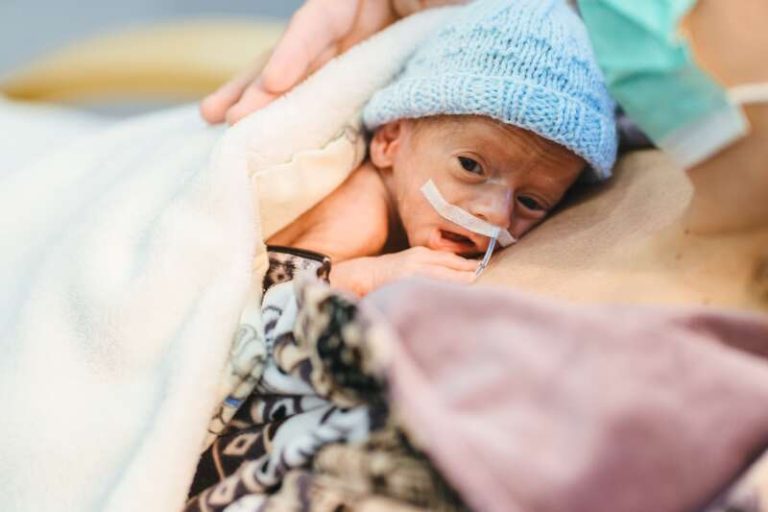 Un bébé prématuré qui fait du peau à peau dans les bras de sa mère.