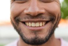 Mais pourquoi les dents jaunissent avec le temps ? Un homme qui sourit avec des dents qui commencent à jaunir.