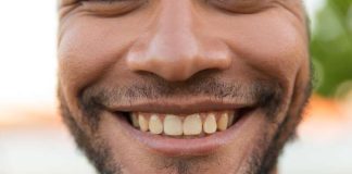 Mais pourquoi les dents jaunissent avec le temps ? Un homme qui sourit avec des dents qui commencent à jaunir.