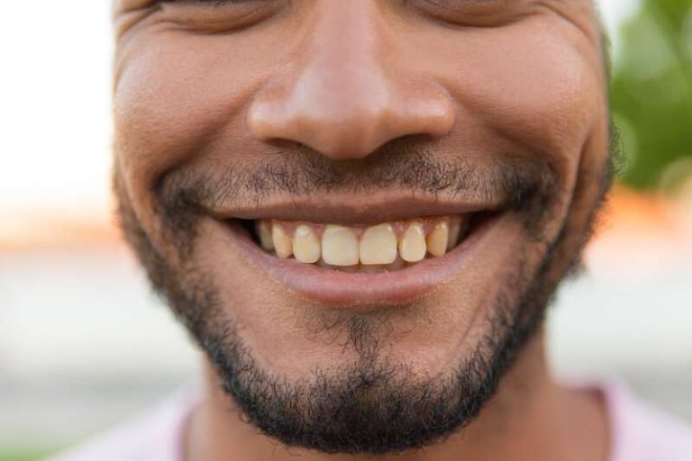 Un homme qui sourit avec des dents qui commencent à jaunir.