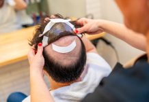 Alopécie : quels sont les risques d’une prothèse capillaire pour homme ? Un jeune qui a recours à une prothèse capillaire pour masquer sa calvitie.