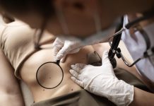 Pénurie de dermatos : un risque pour le dépistage des cancers de la peau ? Une femme qui a réussi à obtenir un rendez-vous chez un dermatologue pour suivre son grain de beauté, malgré la pénurie de dermatologues en France.