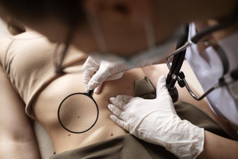 Une femme qui a réussi à obtenir un rendez-vous chez un dermatologue pour suivre son grain de beauté, malgré la pénurie de dermatologues en France.