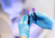 Covid-19 : une simple prise de sang pour repérer les patients les plus à risque Un médecin réalise une prise de sang chez un patient atteint de Covid-19 afin d’évaluer son risque de développer une forme grave.