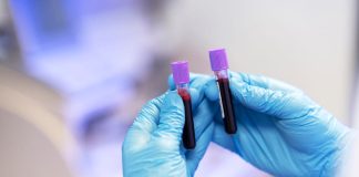 Covid-19 : une simple prise de sang pour repérer les patients les plus à risque Un médecin réalise une prise de sang chez un patient atteint de Covid-19 afin d’évaluer son risque de développer une forme grave.