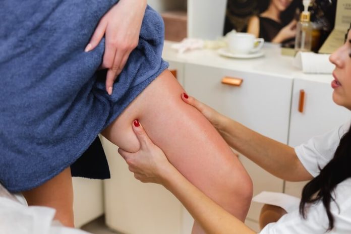 Varices symptomes traitement causes insuffisance veineuse jambes lourdes signes ma sante Une femme se fait masser les jambes en raison pour prévenir ses futures varices.