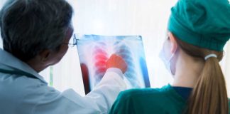 Cancer du poumon : la France s’engage vers un dépistage généralisé à l’horizon 2030 Des médecins mobilisés pour le dépistage du cancer du poumon analysent un scanner thoracique.