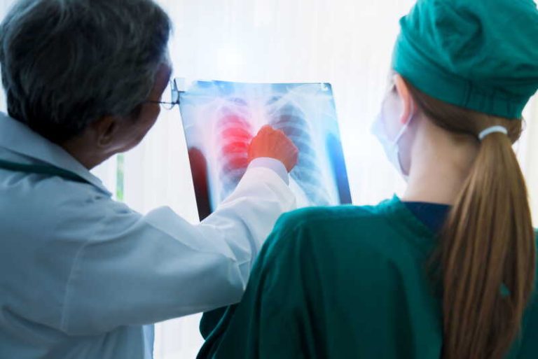 Des médecins mobilisés pour le dépistage du cancer du poumon analysent un scanner thoracique.