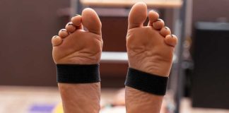 Maladie de Charcot-Marie-Tooth (CMT) : c’est quoi cette maladie qu’on confond avec la SLA ? Une femme qui a les pieds tordus à cause de la maladie de Charcot-Marie-Tooth.