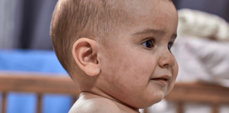 Boutons roses chez l’enfant : quels sont les symptômes de la roséole ? Un nourrisson présentant des taches rosées sur le visage, ressemblant à une roséole.