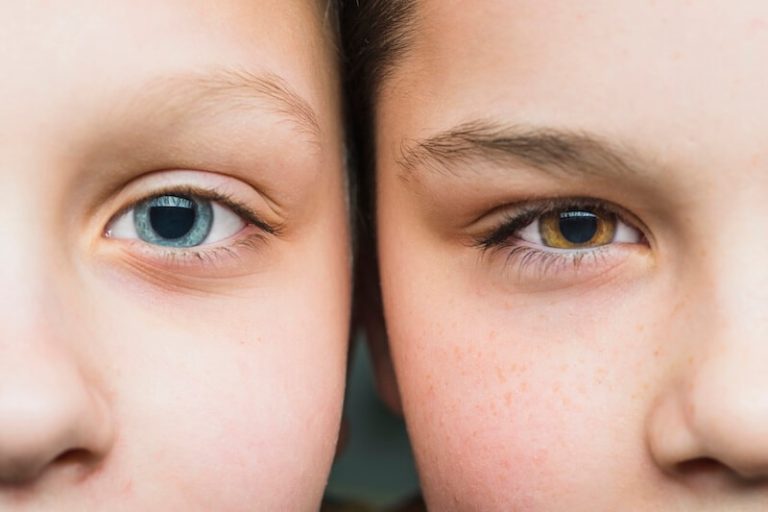 Deux enfants d’une même famille qui n’ont pas la même couleur des yeux.