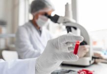 Bientôt un test sanguin pour mesurer l’anxiété ? Un chercheur qui étudie le sang de plusieurs patients pour y détecter des marques génétiques d’anxiété.