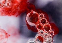 Leucémies, lymphomes : le nombre de cancers du sang ne cesse d’augmenter Les cancers du sang en forte augmentation en France.