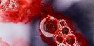 Leucémies, lymphomes : le nombre de cancers du sang ne cesse d’augmenter Les cancers du sang en forte augmentation en France.