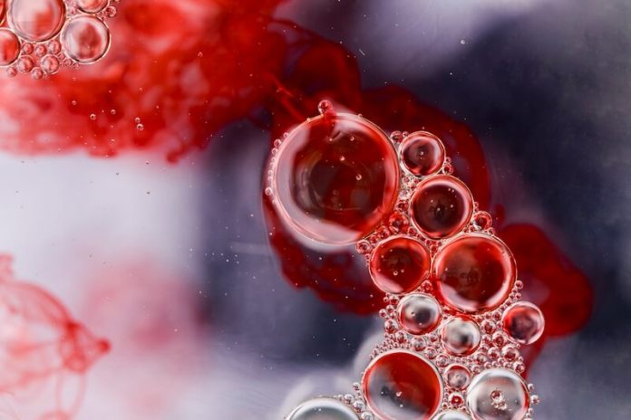 Cancer sang myelome leucemies lymphomes explosion nombre cas ma sante Les cancers du sang en forte augmentation en France.